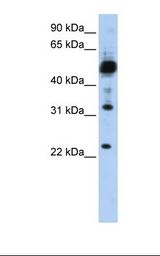 TMEM38B Antibody - Hela cell lysate. Antibody concentration: 1.0 ug/ml. Gel concentration: 12%.  This image was taken for the unconjugated form of this product. Other forms have not been tested.