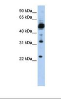 TMEM38B Antibody - Hela cell lysate. Antibody concentration: 1.0 ug/ml. Gel concentration: 12%.  This image was taken for the unconjugated form of this product. Other forms have not been tested.