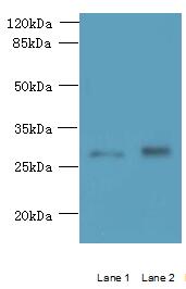 TMEM38B Antibody - Western blot. All lanes: TMEM38B antibody at 1.5 ug/ml. Lane 1: Mouse thymus tissue. Lane 2: Mouse liver tissue. Secondary Goat polyclonal to Rabbit IgG at 1:10000 dilution. Predicted band size: 33 kDa. Observed band size: 33 kDa.