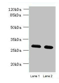 TMEM38B Antibody - Western blot All lanes: TMEM38B antibody at 1.5µg/ml Lane 1: Mouse thymus tissue Lane 2: Mouse liver tissue Secondary Goat polyclonal to rabbit IgG at 1/10000 dilution Predicted band size: 33 kDa Observed band size: 33 kDa