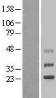TMEM38B Protein - Western validation with an anti-DDK antibody * L: Control HEK293 lysate R: Over-expression lysate