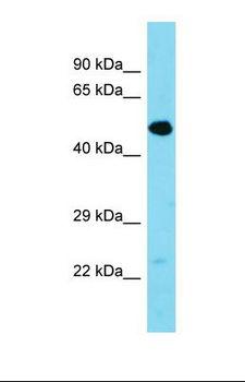 TMEM39A Antibody - Western blot of Mouse Pancreas. Tmem39a antibody dilution 1.0 ug/ml.  This image was taken for the unconjugated form of this product. Other forms have not been tested.