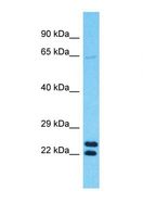 TMEM39B Antibody - Western blot of Human U937. TMEM39B antibody dilution 1.0 ug/ml.  This image was taken for the unconjugated form of this product. Other forms have not been tested.