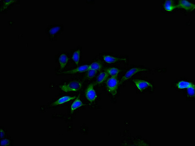 TMEM40 Antibody - Immunofluorescent analysis of Hela cells using TMEM40 Antibody at dilution of 1:100 and Alexa Fluor 488-congugated AffiniPure Goat Anti-Rabbit IgG(H+L)