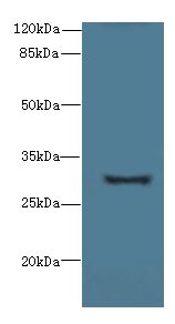 TMEM41A Antibody - Western blot. All lanes: TMEM41A antibody at 0.5 ug/ml+ Mouse liver tissue Goat polyclonal to rabbit at 1:10000 dilution. Predicted band size: 30 kDa. Observed band size: 30 kDa.