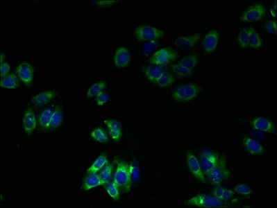 TMEM41A Antibody - Immunofluorescent analysis of HepG2 cells using TMEM41A Antibody at dilution of 1:100 and Alexa Fluor 488-congugated AffiniPure Goat Anti-Rabbit IgG(H+L)