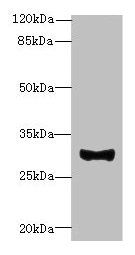 TMEM41A Antibody - Western blot All lanes: TMEM41A antibody at 0.5µg/ml + Mouse liver tissue Secondary Goat polyclonal to rabbit IgG at 1/10000 dilution Predicted band size: 30 kDa Observed band size: 30 kDa
