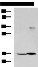 TMEM42 Antibody - Western blot analysis of A172 cell and Human cerebrum tissue lysates  using TMEM42 Polyclonal Antibody at dilution of 1:800