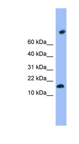 TMEM42 Antibody - TMEM42 antibody Western blot of ACHN lysate. This image was taken for the unconjugated form of this product. Other forms have not been tested.