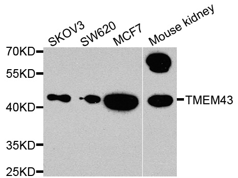 TMEM43 Antibody - Western blot analysis of extracts of various cells.