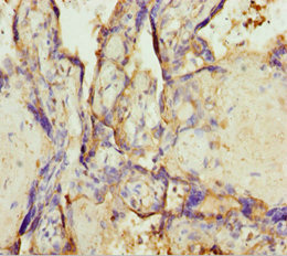 TMEM43 Antibody - Immunohistochemistry of paraffin-embedded human placenta tissue at dilution 1:100
