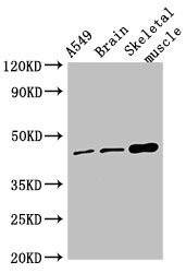 TMEM43 Antibody - Western Blot Positive WB detected in:A549 whole cell lysate,Mouse brain tissue,Mouse skeletal muscle tissue All Lanes:TMEM43 antibody at 4µg/ml Secondary Goat polyclonal to rabbit IgG at 1/50000 dilution Predicted band size: 45 KDa Observed band size: 45 KDa