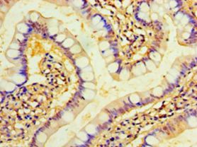 TMEM44 Antibody - Immunohistochemistry of paraffin-embedded human small intestine using antibody at 1:100 dilution.  This image was taken for the unconjugated form of this product. Other forms have not been tested.