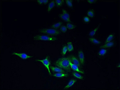 TMEM44 Antibody - Immunofluorescent analysis of HepG2 cells using TMEM44 Antibody at dilution of 1:100 and Alexa Fluor 488-congugated AffiniPure Goat Anti-Rabbit IgG(H+L)