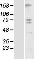 TMEM44 Protein - Western validation with an anti-DDK antibody * L: Control HEK293 lysate R: Over-expression lysate