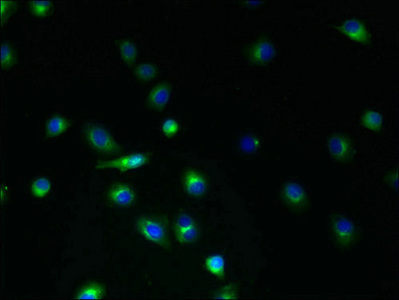 TMEM45A Antibody - Immunofluorescent analysis of A2780 cells using TMEM45A Antibody at dilution of 1:100 and Alexa Fluor 488-congugated AffiniPure Goat Anti-Rabbit IgG(H+L)
