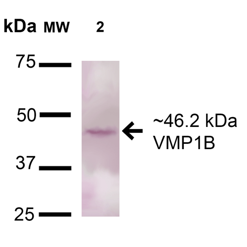 TMEM49 Antibody - Western blot analysis of Human A549 showing detection of 46.2kDa VMP1 protein using Rabbit Anti-VMP1 Polyclonal Antibody. Lane 1: Molecular Weight Ladder (MW). Lane 2: A549 cell lysates. Load: 15 µg. Block: 5% Skim Milk in 1X TBST. Primary Antibody: Rabbit Anti-VMP1 Polyclonal Antibody  at 1:1000 for 16 hours at 4°C. Secondary Antibody: Goat-Anti-Rabbit IgG: HRP at 1:200 for 60 min at RT. Color Development: TMB. Predicted/Observed Size: 46.2kDa. Other Band(s): Multiple bands for A549; Rat Brain shows a band at 60kDa, 75kDa, and 150kDa.