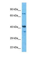 TMEM49 Antibody - Western blot of VMP1 Antibody with human HepG2 Whole Cell lysate.  This image was taken for the unconjugated form of this product. Other forms have not been tested.