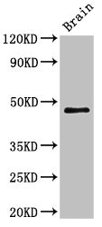 TMEM49 Antibody - Western Blot Positive WB detected in:Mouse brain tissue All Lanes:VMP1 antibody at 3µg/ml Secondary Goat polyclonal to rabbit IgG at 1/50000 dilution Predicted band size: 47,25 KDa Observed band size: 47 KDa