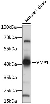 TMEM49 Antibody - Western blot analysis of extracts of mouse kidney, using VMP1 antibody at 1:1000 dilution. The secondary antibody used was an HRP Goat Anti-Rabbit IgG (H+L) at 1:10000 dilution. Lysates were loaded 25ug per lane and 3% nonfat dry milk in TBST was used for blocking. An ECL Kit was used for detection and the exposure time was 5s.