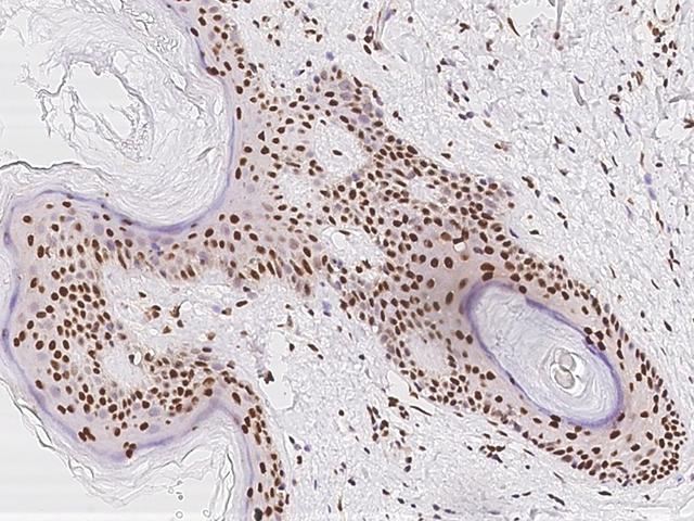 TMEM49 Antibody - Immunochemical staining of human VMP1 in human skin with rabbit polyclonal antibody at 1:500 dilution, formalin-fixed paraffin embedded sections.