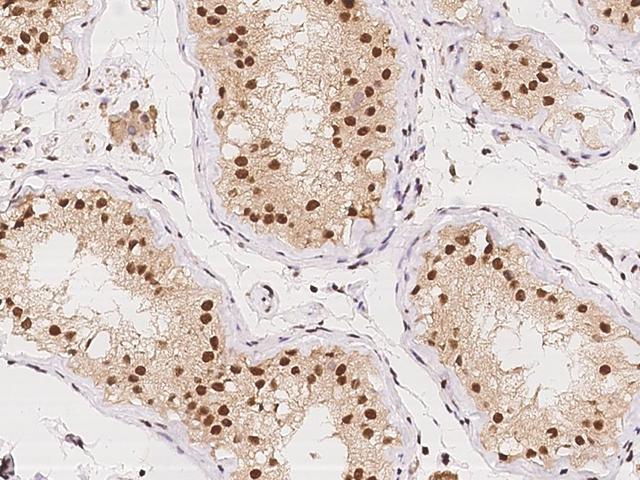 TMEM49 Antibody - Immunochemical staining of human VMP1 in human testis with rabbit polyclonal antibody at 1:500 dilution, formalin-fixed paraffin embedded sections.