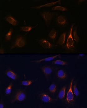TMEM49 Antibody - Immunofluorescence analysis of U-2OS cells using VMP1 Polyclonal Antibody at dilution of 1:100 (40x lens).Blue: DAPI for nuclear staining.