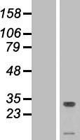 TMEM50A Protein - Western validation with an anti-DDK antibody * L: Control HEK293 lysate R: Over-expression lysate