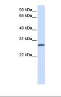 TMEM51 Antibody - Fetal lung lysate. Antibody concentration: 1.0 ug/ml. Gel concentration: 12%.  This image was taken for the unconjugated form of this product. Other forms have not been tested.