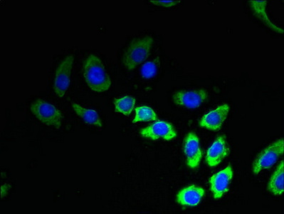 TMEM53 Antibody - Immunofluorescent analysis of A549 cells using TMEM53 Antibody at dilution of 1:100 and Alexa Fluor 488-congugated AffiniPure Goat Anti-Rabbit IgG(H+L)