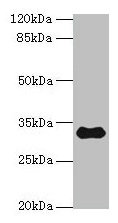 TMEM53 Antibody - Western blot All lanes: TMEM53 antibody at 5µg/ml + Mouse brain tissue Secondary Goat polyclonal to rabbit IgG at 1/10000 dilution Predicted band size: 32, 24 kDa Observed band size: 32 kDa
