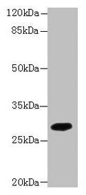 TMEM55A Antibody - Western blot All lanes: TMEM55A antibody at 5µg/ml + Mouse liver tissue Secondary Goat polyclonal to rabbit IgG at 1/10000 dilution Predicted band size: 28 kDa Observed band size: 28 kDa
