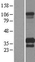TMEM55B Protein - Western validation with an anti-DDK antibody * L: Control HEK293 lysate R: Over-expression lysate