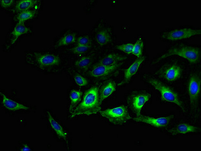 TMEM56 Antibody - Immunofluorescent analysis of Hela cells using TMEM56 Antibody at dilution of 1:100 and Alexa Fluor 488-congugated AffiniPure Goat Anti-Rabbit IgG(H+L)