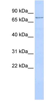 TMEM57 / Macoilin 1 Antibody - Lane: MDA_MB435 cell lysate Antibody Titration: 1 ug/ml.  This image was taken for the unconjugated form of this product. Other forms have not been tested.