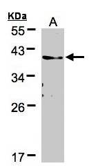 TMEM59 Antibody - Sample (30 ug of whole cell lysate). A: A431. 12% SDS PAGE. HSPC001 / TMEM59 antibody diluted at 1:500
