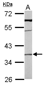 TMEM59 Antibody - Sample (50 ug of whole cell lysate). A: mouse liver. 10% SDS PAGE. HSPC001 / TMEM59 antibody diluted at 1:1000.