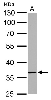 TMEM59 Antibody - TMEM59 antibody detects TMEM59 protein by Western blot analysis. A. 50 ug rat kidney lysate/extract. 10 % SDS-PAGE. TMEM59 antibody dilution:1:1000