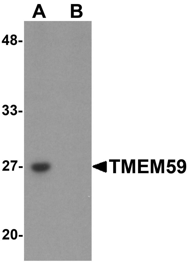 TMEM59 Antibody - Western blot analysis of TMEM59 in human kidney tissue lysate with TMEM59 antibody at 1 ug/ml in (A) the absence and (B) the presence of blocking peptide.