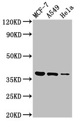 TMEM59 Antibody - Positive Western Blot detected in MCF-7 whole cell lysate, A549 whole cell lysate, Hela whole cell lysate. All lanes: TMEM59 antibody at 3 µg/ml Secondary Goat polyclonal to rabbit IgG at 1/50000 dilution. Predicted band size: 37 KDa. Observed band size: 37 KDa