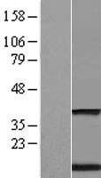 TMEM59 Protein - Western validation with an anti-DDK antibody * L: Control HEK293 lysate R: Over-expression lysate