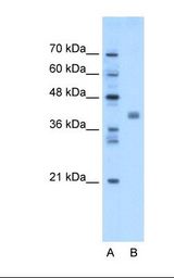 TMEM59L Antibody - Lane A: Marker. Lane B: Transfected 293T cell lysate. Antibody concentration: 1.25 ug/ml. Gel concentration: 12%.  This image was taken for the unconjugated form of this product. Other forms have not been tested.