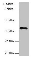TMEM59L Antibody - Western blot All lanes: TMEM59L antibody at 3µg/ml + 293T whole cell lysate Secondary Goat polyclonal to rabbit IgG at 1/10000 dilution Predicted band size: 38 kDa Observed band size: 38 kDa