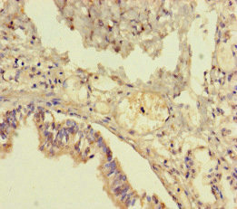 TMEM64 Antibody - Immunohistochemistry of paraffin-embedded human lung tissue at dilution of 1:100
