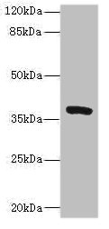 TMEM64 Antibody - Western blot All Lanes: TMEM64 antibody IgG at 8ug/ml+ Mouse brain tissue Secondary Goat polyclonal to rabbit IgG at 1/10000 dilution Predicted band size: 40,13,15,34 kDa Observed band size: 40 kDa