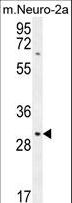 TMEM65 Antibody - TMEM65 Antibody western blot of mouse Neuro-2a cell line lysates (35 ug/lane). The TMEM65 antibody detected the TMEM65 protein (arrow).