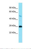 TMEM65 Antibody - Western blot of Human Placenta . TMEM65 antibody dilution 1.0 ug/ml.  This image was taken for the unconjugated form of this product. Other forms have not been tested.