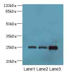 TMEM65 Antibody - Western blot. All lanes: TMEM65 antibody at 6 ug/ml. Lane 1: Mouse liver tissue. Lane 2: Mouse kidney tissue. Lane 3: Mouse gonadal tissue. Secondary Goat polyclonal to Rabbit IgG at 1:10000 dilution. Predicted band size: 25 kDa. Observed band size: 25 kDa.