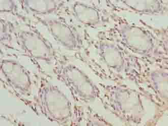 TMEM65 Antibody - Immunohistochemistry of paraffin-embedded human rectum tissue using antibody at dilution of 1:100.