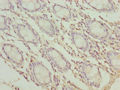 TMEM65 Antibody - Immunohistochemistry of paraffin-embedded human rectum tissue using TMEM65 Antibody at dilution of 1:100